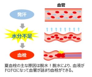 夏の脳梗塞対策